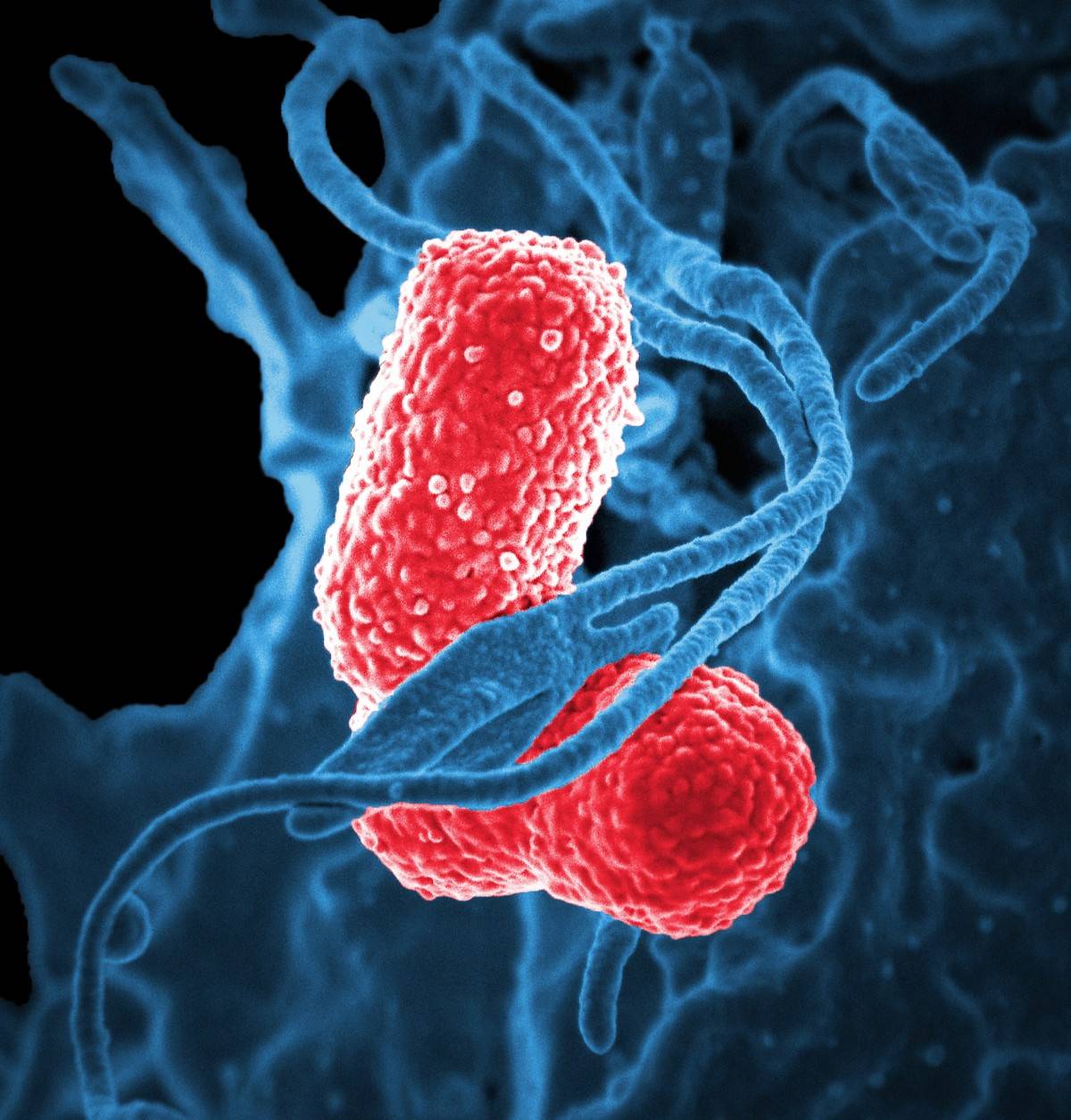 bactérie vue au microscope électronique